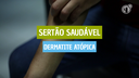 Sertão Saudável Dermatite atópica